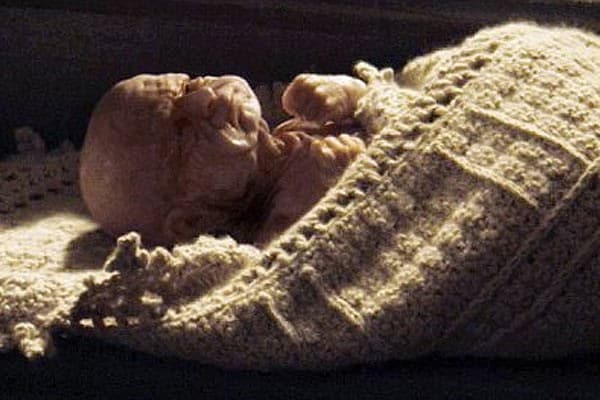 9) Benjamin Button is perhaps an extreme literal e