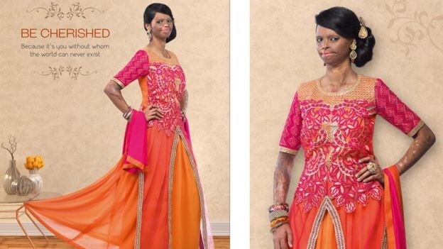 Laxmi Saa for Viva N Diva’s Face of Courage campaign