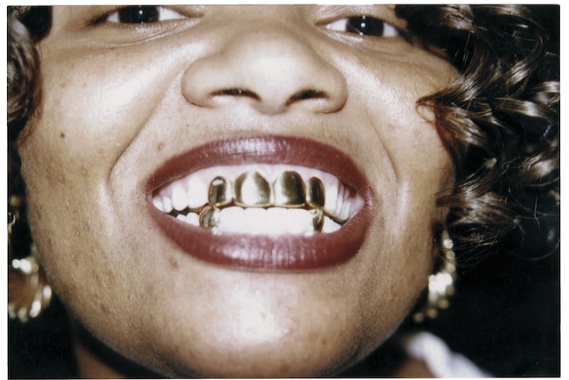 MOUTH FULL OF GOLDS IDEA Eddie plein