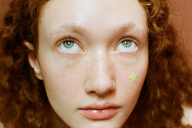Breakout Years teen acne pimple patches