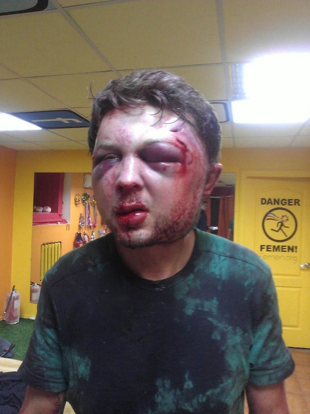 Victor Svyatski beaten up by police 9