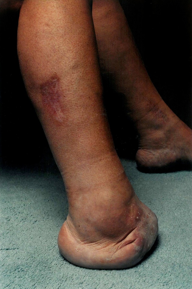 Bob Walden: Negligence Photography 3