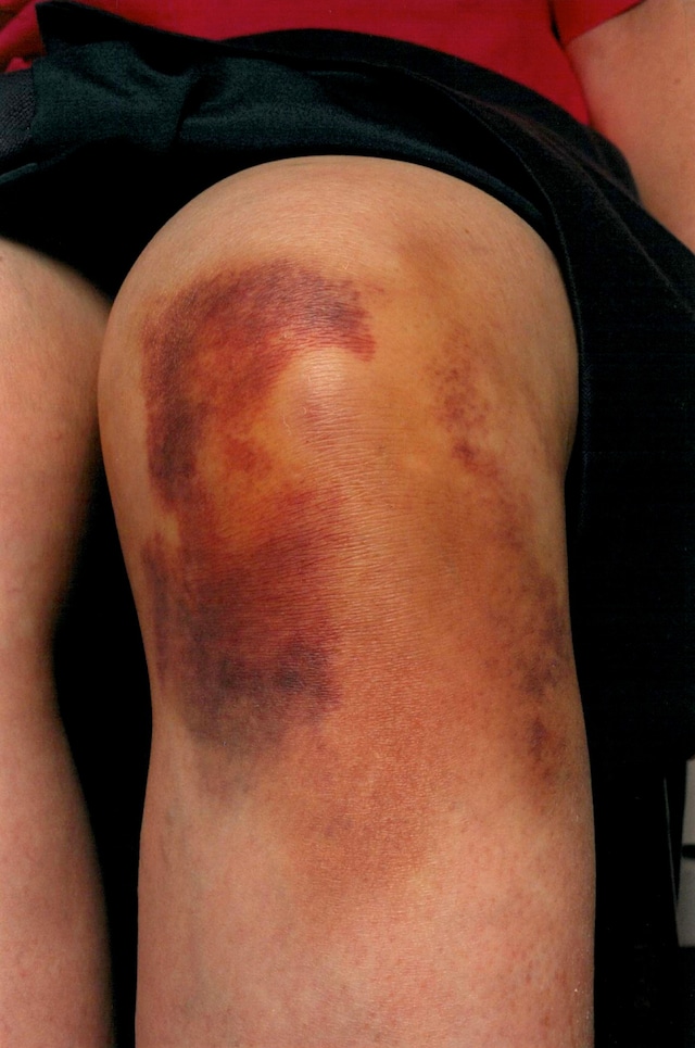 Bob Walden: Negligence Photography 17