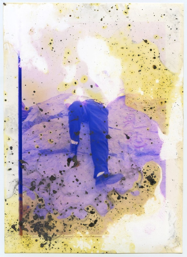 Untitled-4_Lunar-Caustic_MGTS 3