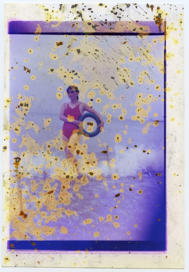 Untitled-8_Lunar-Caustic_MGTS 7