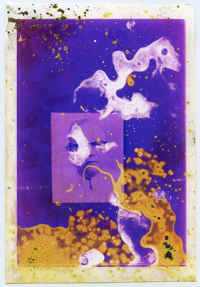 Untitled-12_Lunar-Caustic_MGTS 11