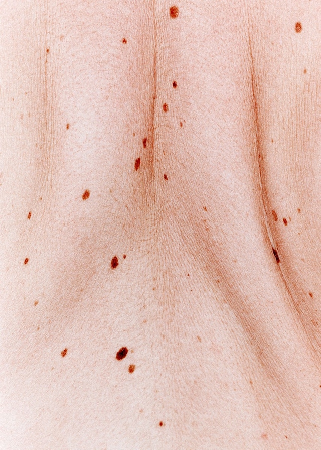 Peter Kaaden’s NAAKED, Dazed 13