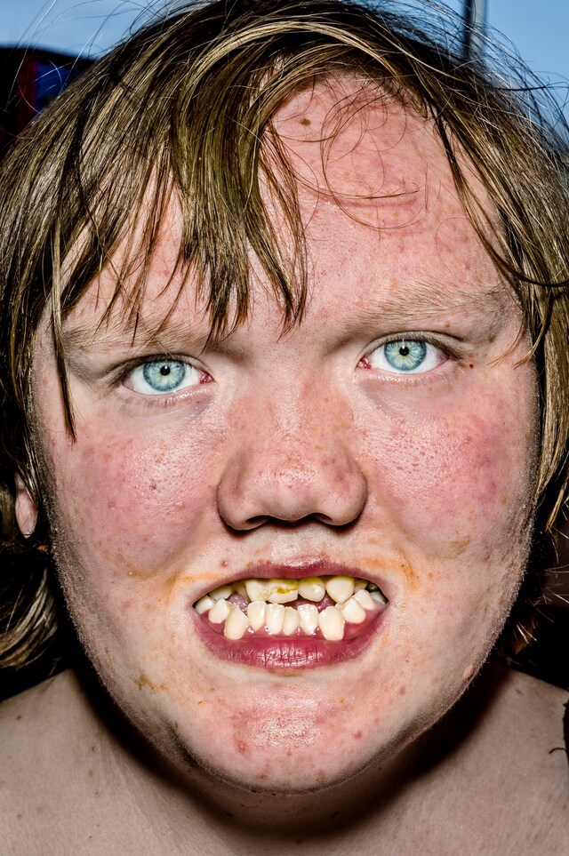 Bruce Gilden&#39;s Face &quot;Britney Mey&quot;, St Paul, Minnesota, USA 1