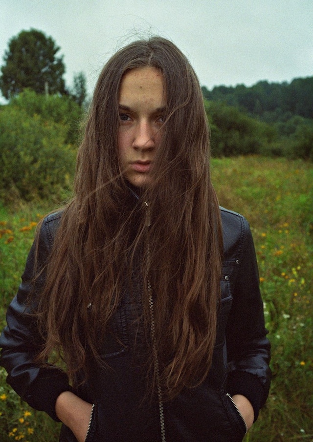 Irina Yulieva’s Broken Knees 0