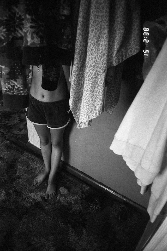 Irina Yulieva’s Broken Knees 16