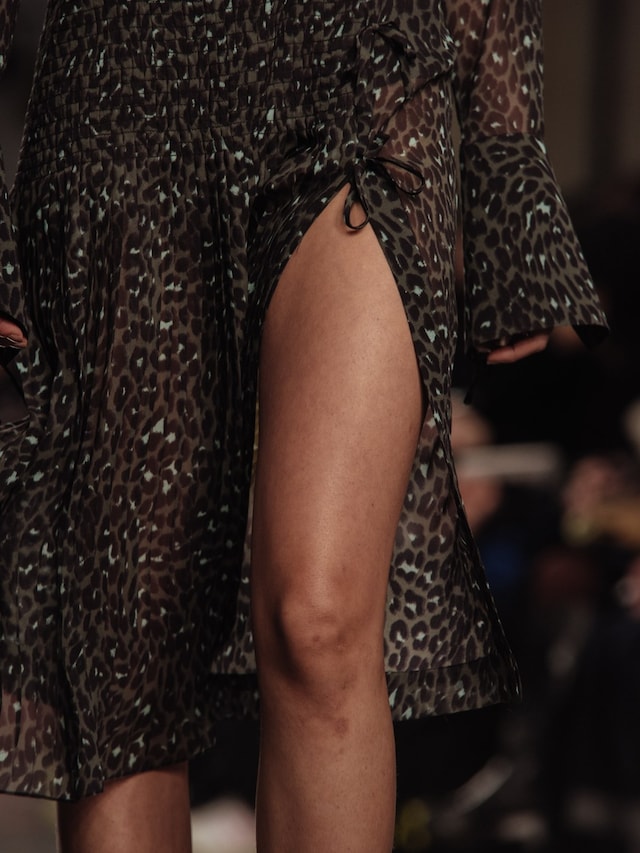 Topshop Unique AW16 22