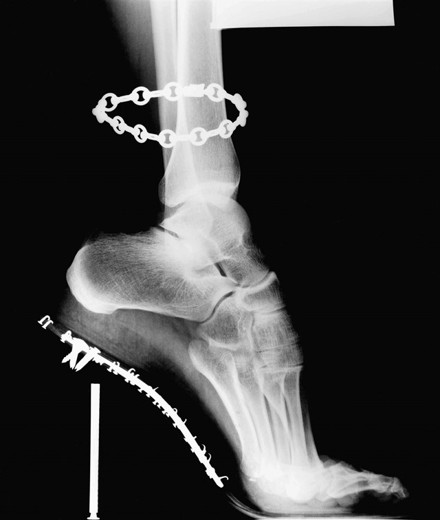X-Ray, Van Cleef &amp; Arpels, French Vogue, 1994