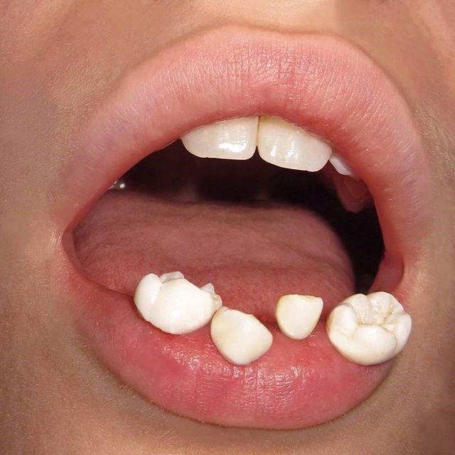 ig of the week gabbois 2