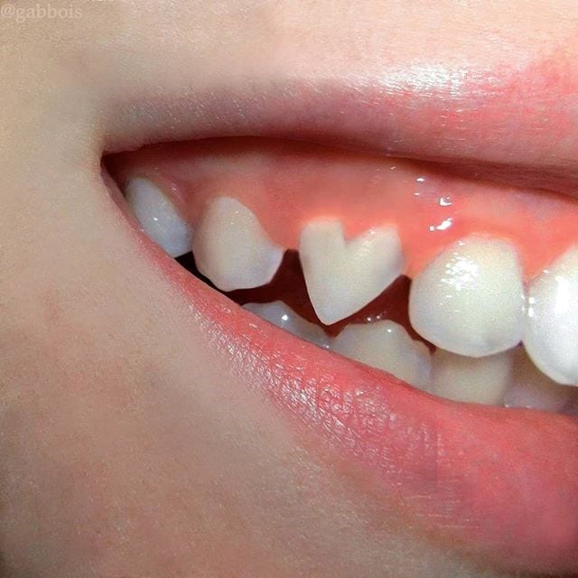 ig of the week gabbois 17