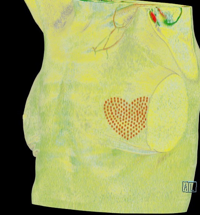 image 1 0