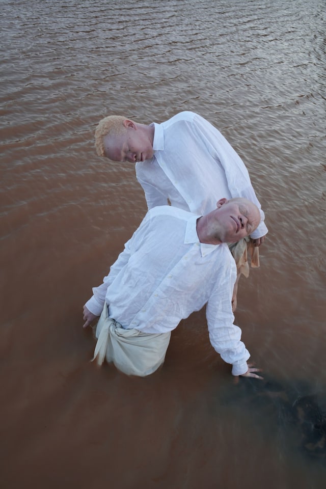 Albinism, photography Denisse Ariana P&#233;rez 0