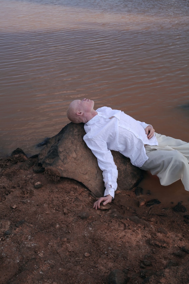 Albinism, photography Denisse Ariana P&#233;rez 3