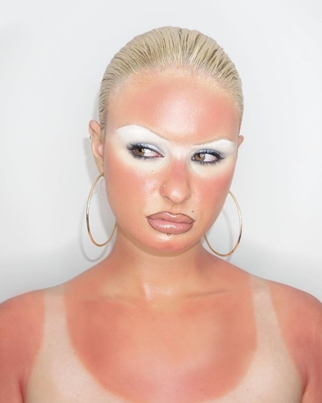 How Sunburns And Tan Lines Became An Aspirational Aesthetic Dazed