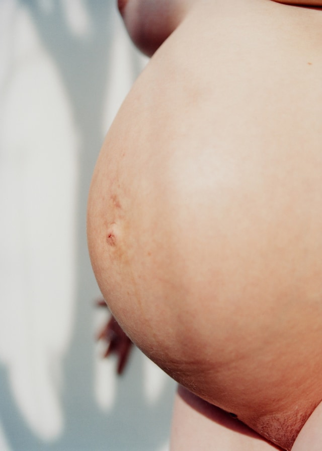 Ezekiel, Somewhere between a dog and a doll, photo book 10