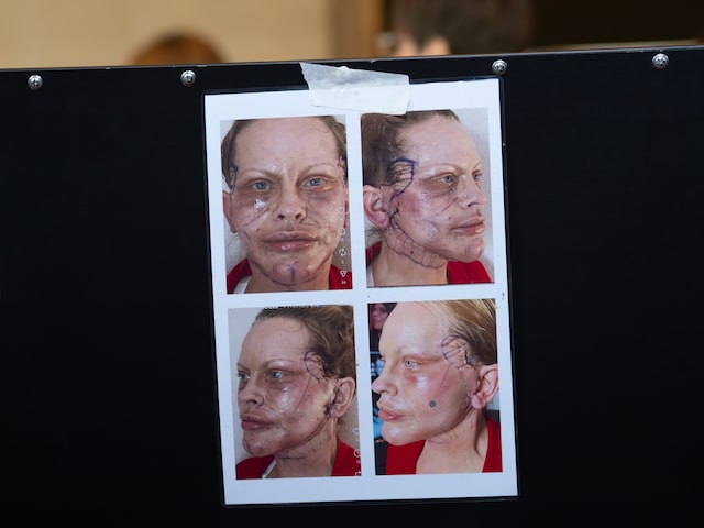 GettyImages-2264079032