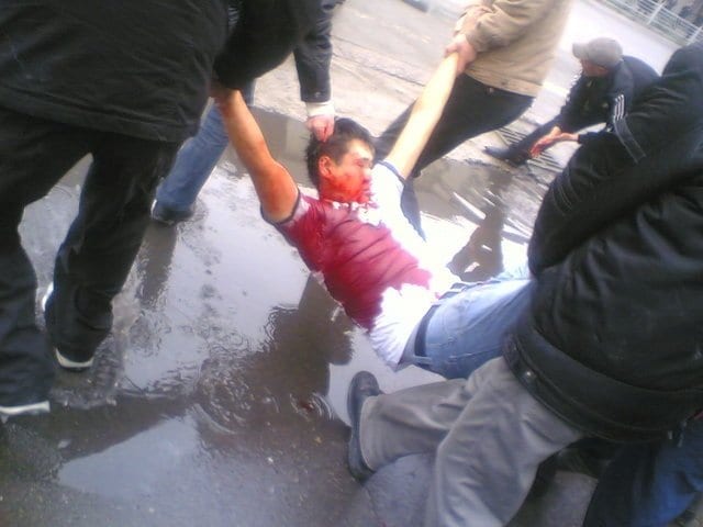 A protester is badly wounded as the police use sni 3