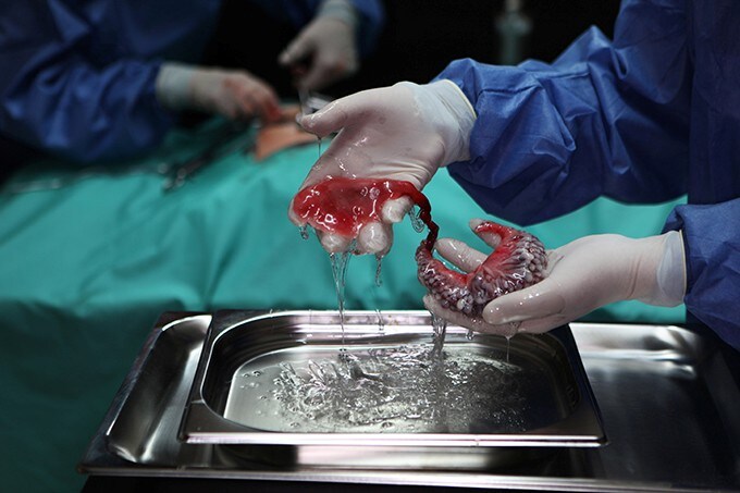 Circumventive Organs