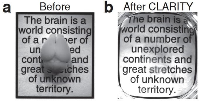 Brain-CLARITY