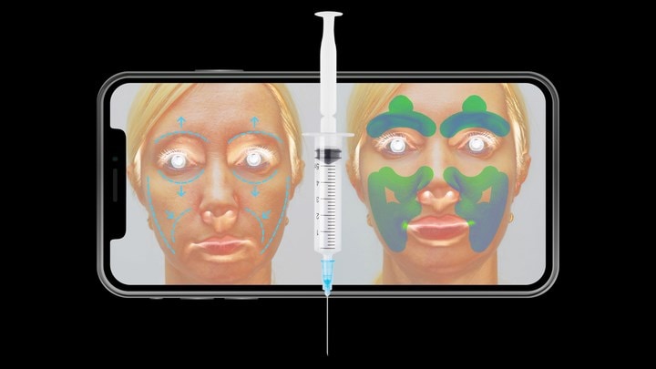 Botox, TikTok