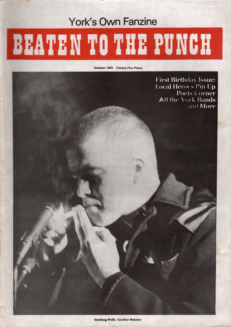 Skinhead15