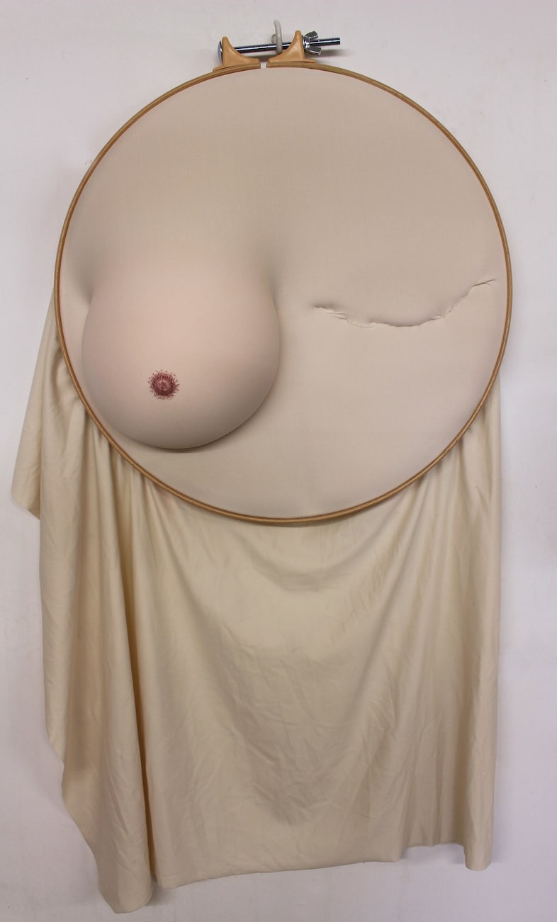 Ectomy(1)