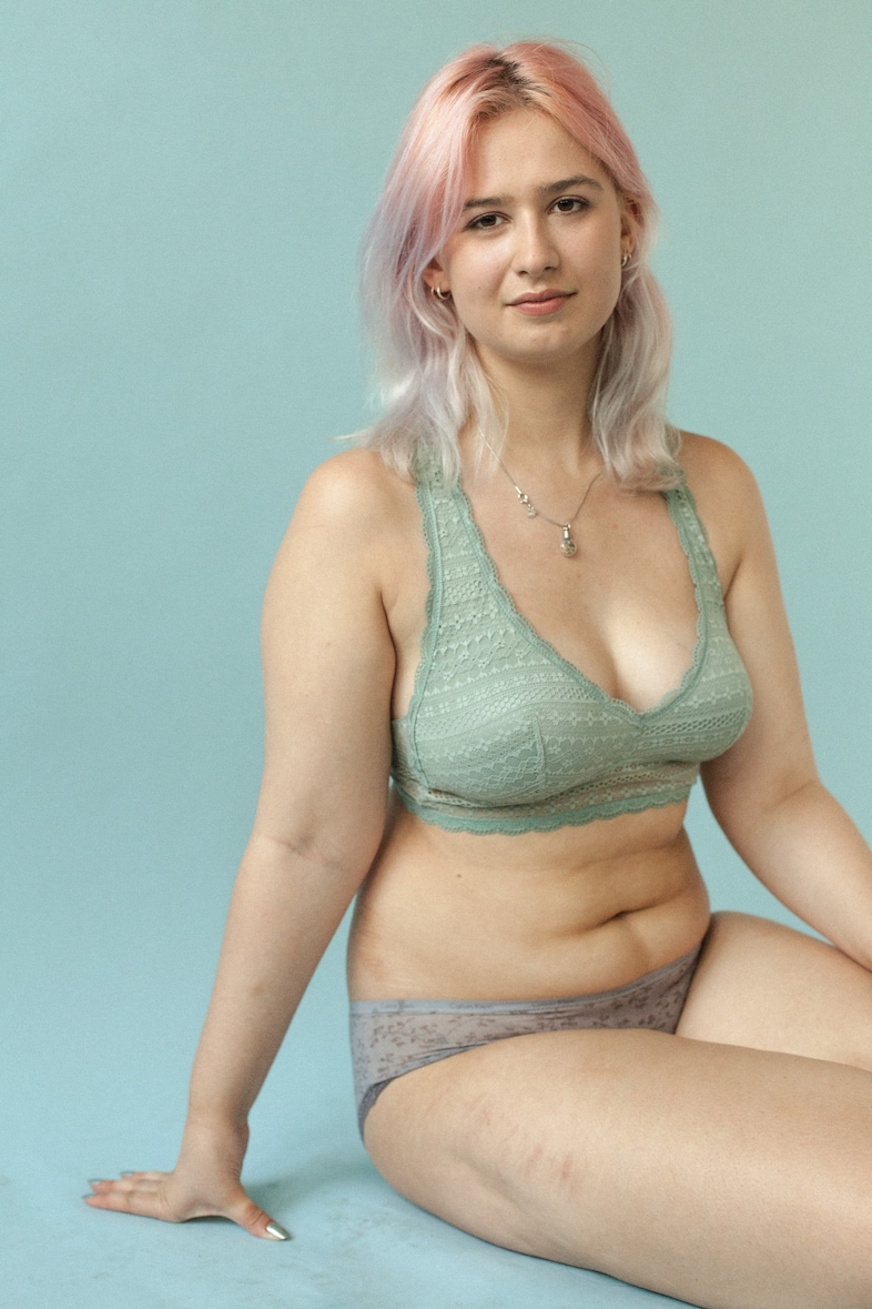 Photographing the stories behind our scars and marks