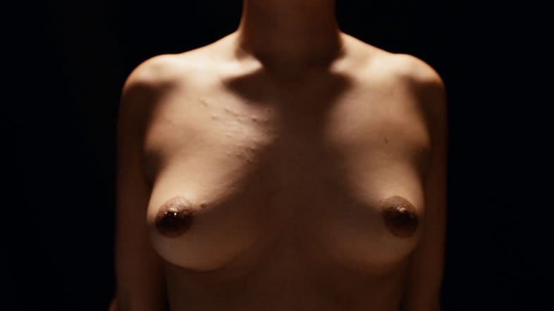 nip1