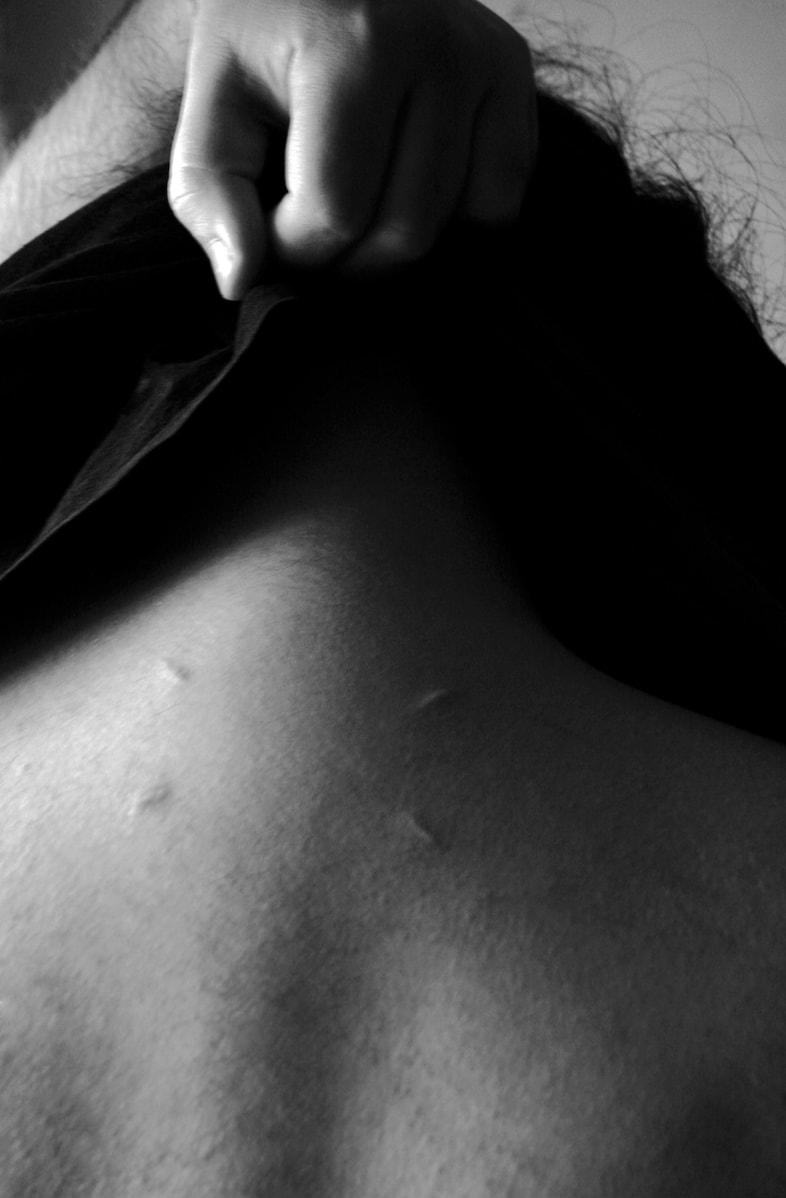 cicatrices0