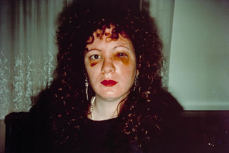 Nan Goldin, “Nan one month after being battered” (1984)