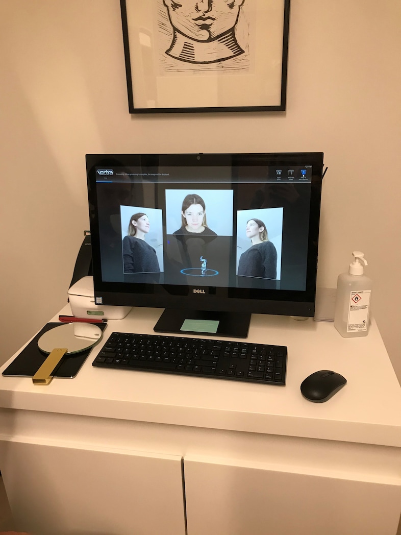 3d face scan treatment laser dr Costas Papageorgiou