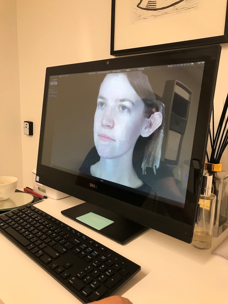 3d face scan treatment laser dr Costas Papageorgiou