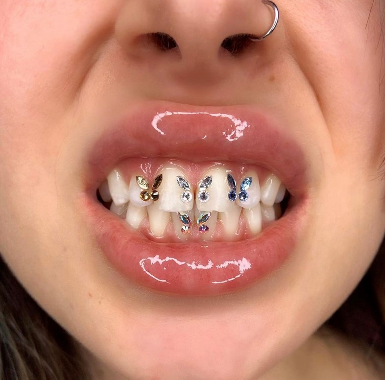 Tooth gems by Graciella Masterton