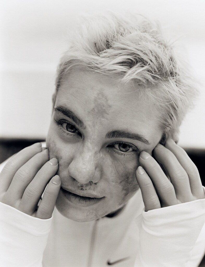 Bebe Vio, Dazed Summer 2024 6