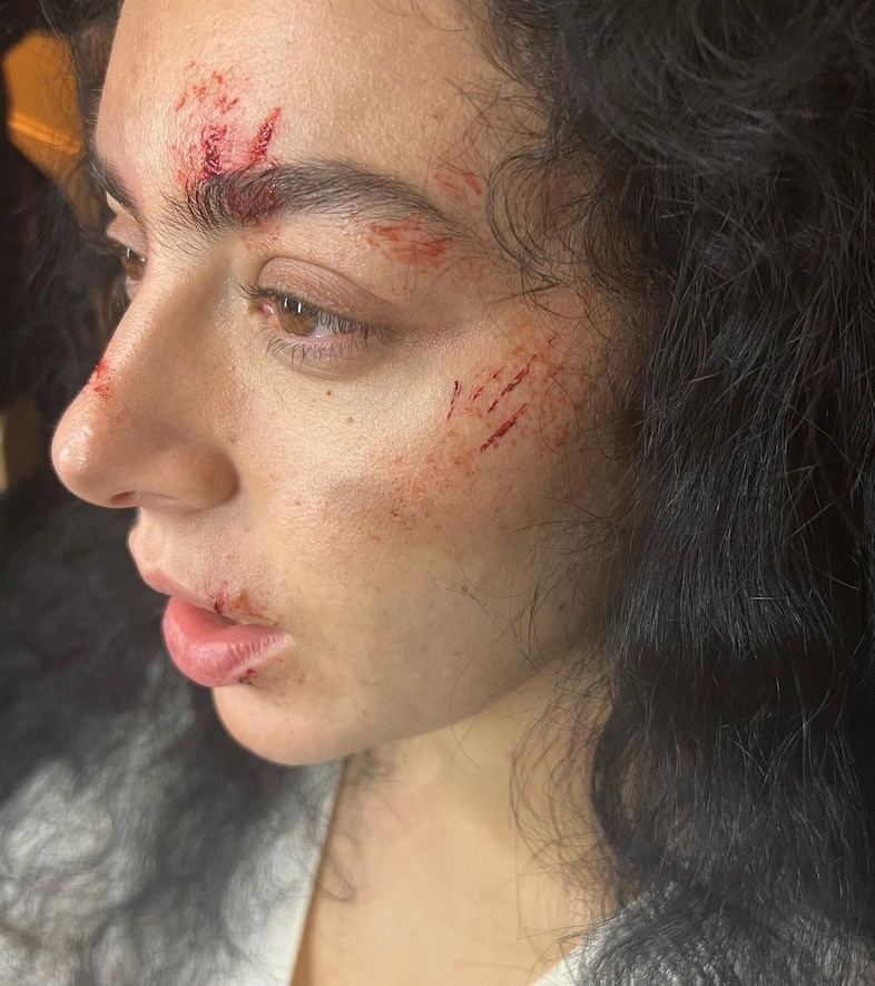 The Aestheticisation of Pain Within Beauty 1