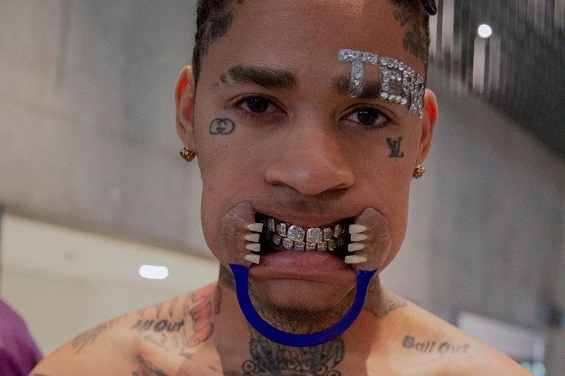 Who wants to buy those crazy HBA grills? Lots of people | Dazed