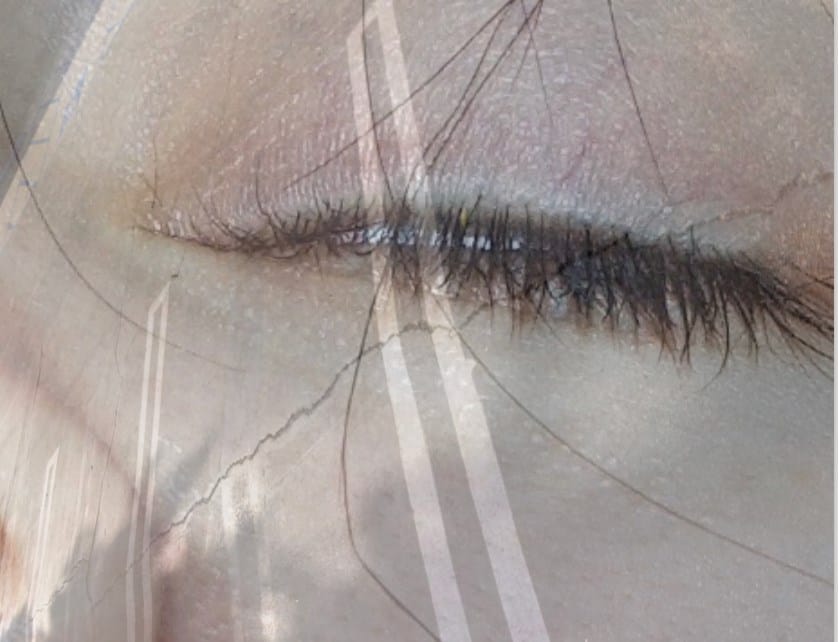 The Flesh That Says Yes 2