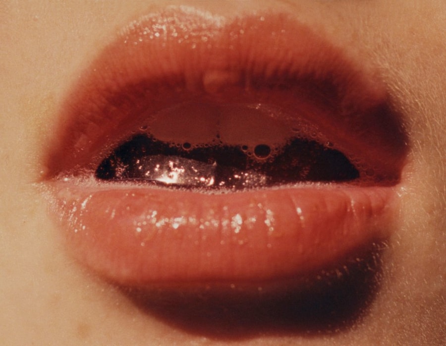 Harley Weir Dazed 100 0