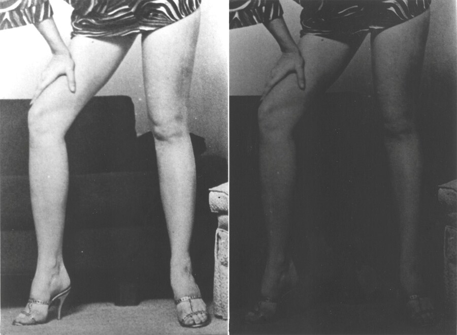 Score for a sequence of poses 1 5