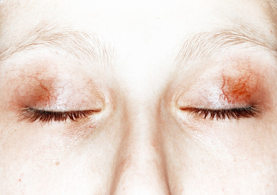 Peter Kaaden’s NAAKED, Dazed 15