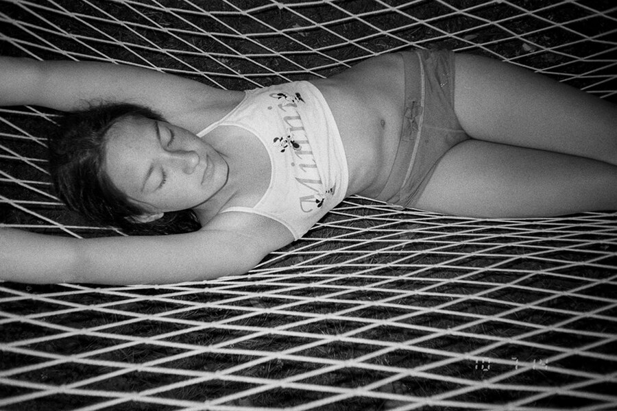 Irina Yulieva’s Broken Knees 14