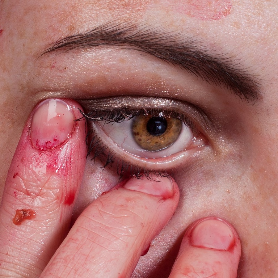 eyeball 3