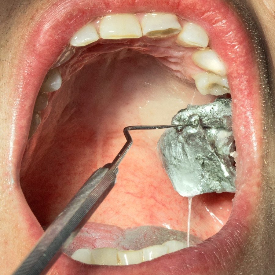 BODY HOLES by New Scenario 1