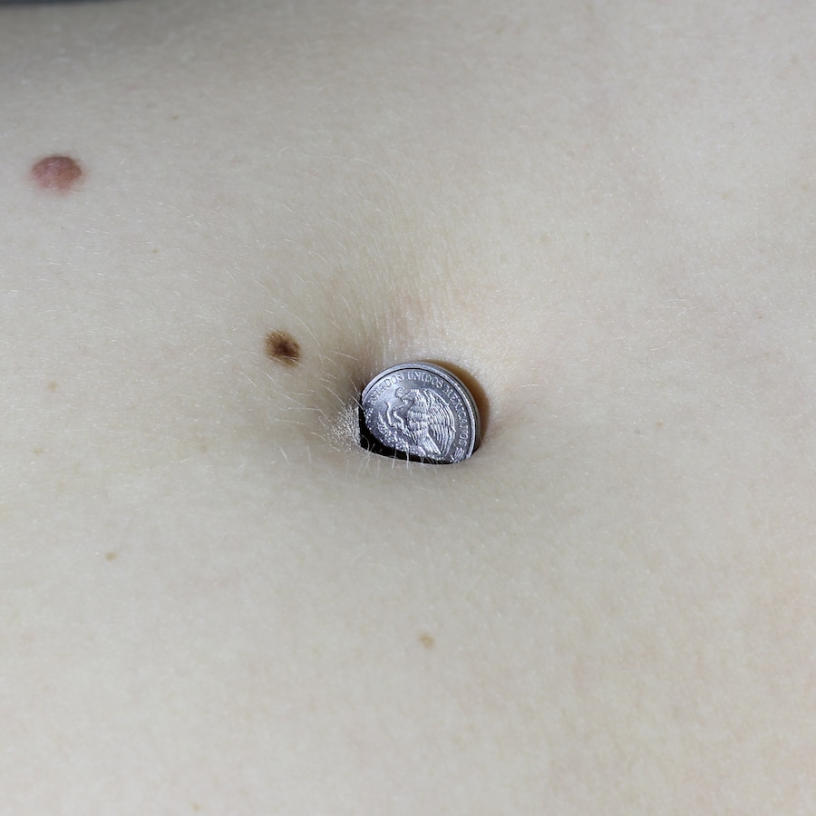 BODY HOLES by New Scenario 6