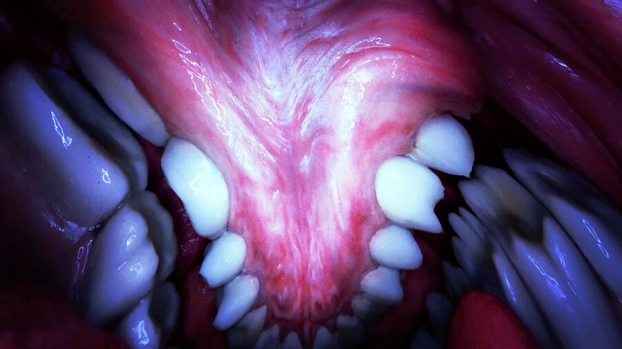 MouthMantra 14