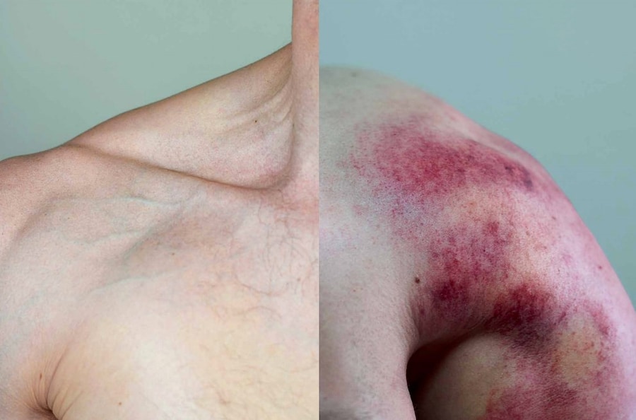 Florian Hetz’s The Matter of Abscence 8